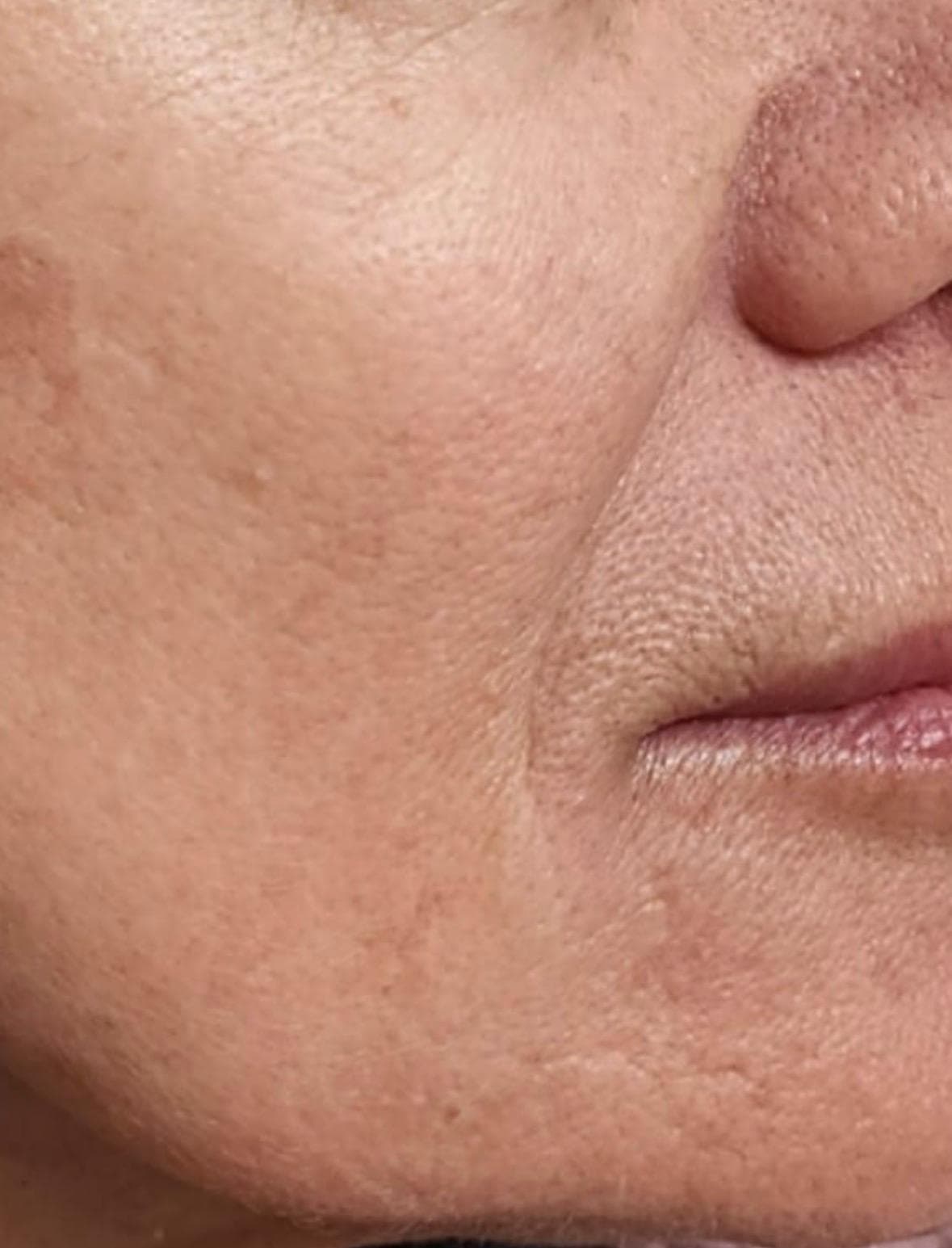 אנטי אייג'ינג