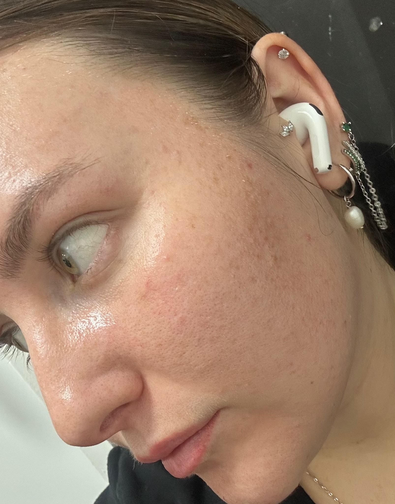 אחרי הטיפול